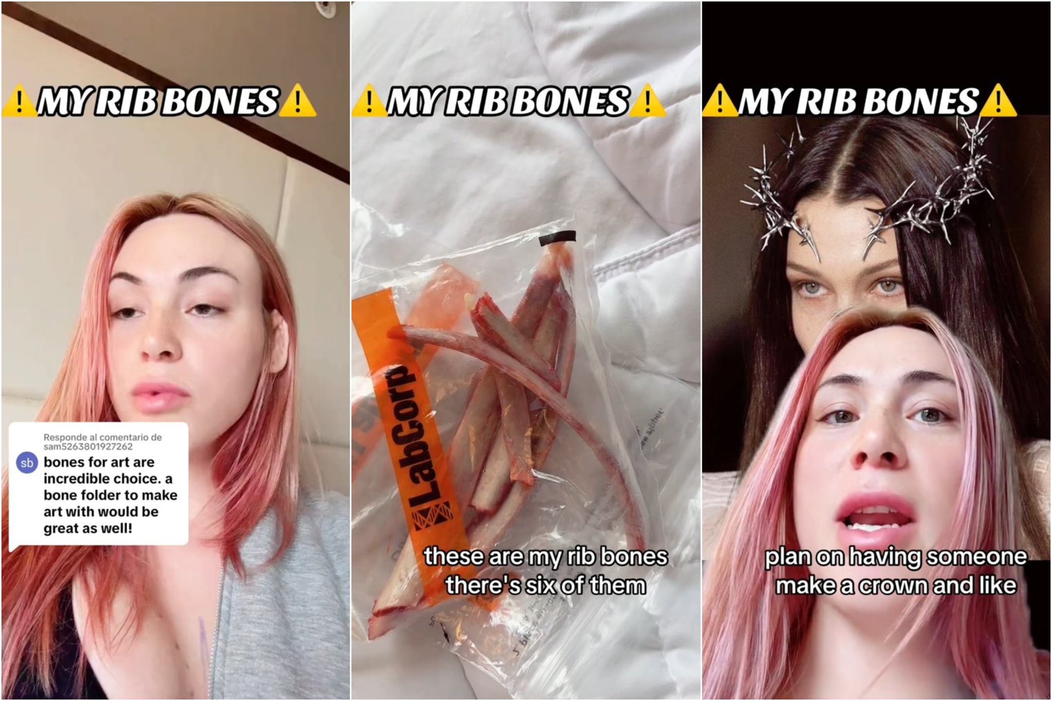 A trans le quitan 4 costillas