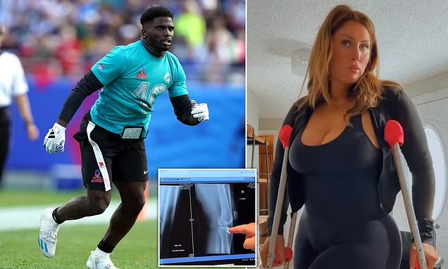 NFL-Champion bricht kurvigem Model das Bein und hat dann Sex mit ihr: Berichten zufolge