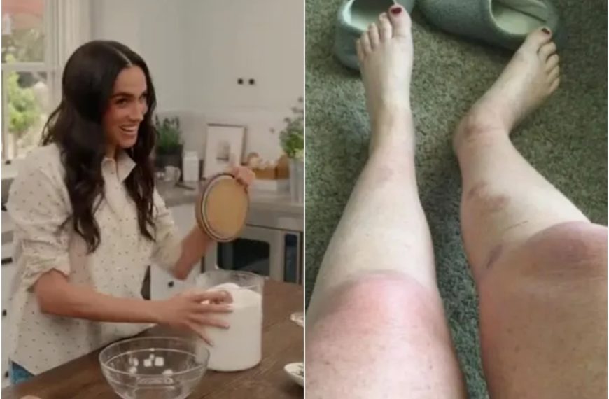Meghan Markle poursuivie en justice par un fan : « Je me suis brûlée avec ses sels de bain »