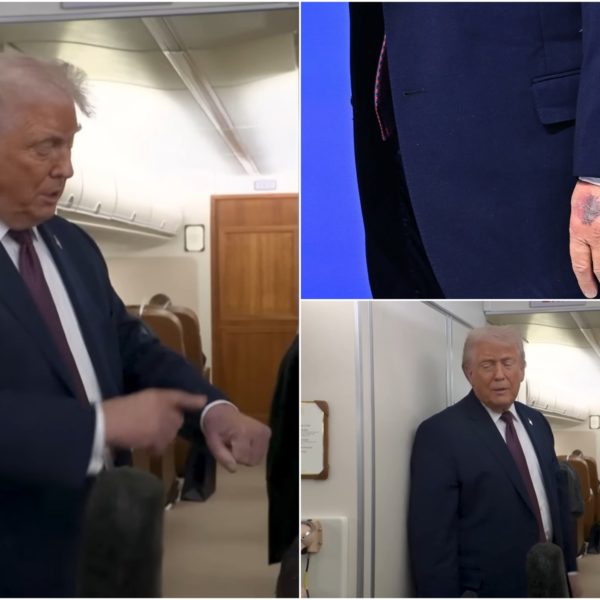 El misterioso hematoma de Trump en su mano en Davos:…