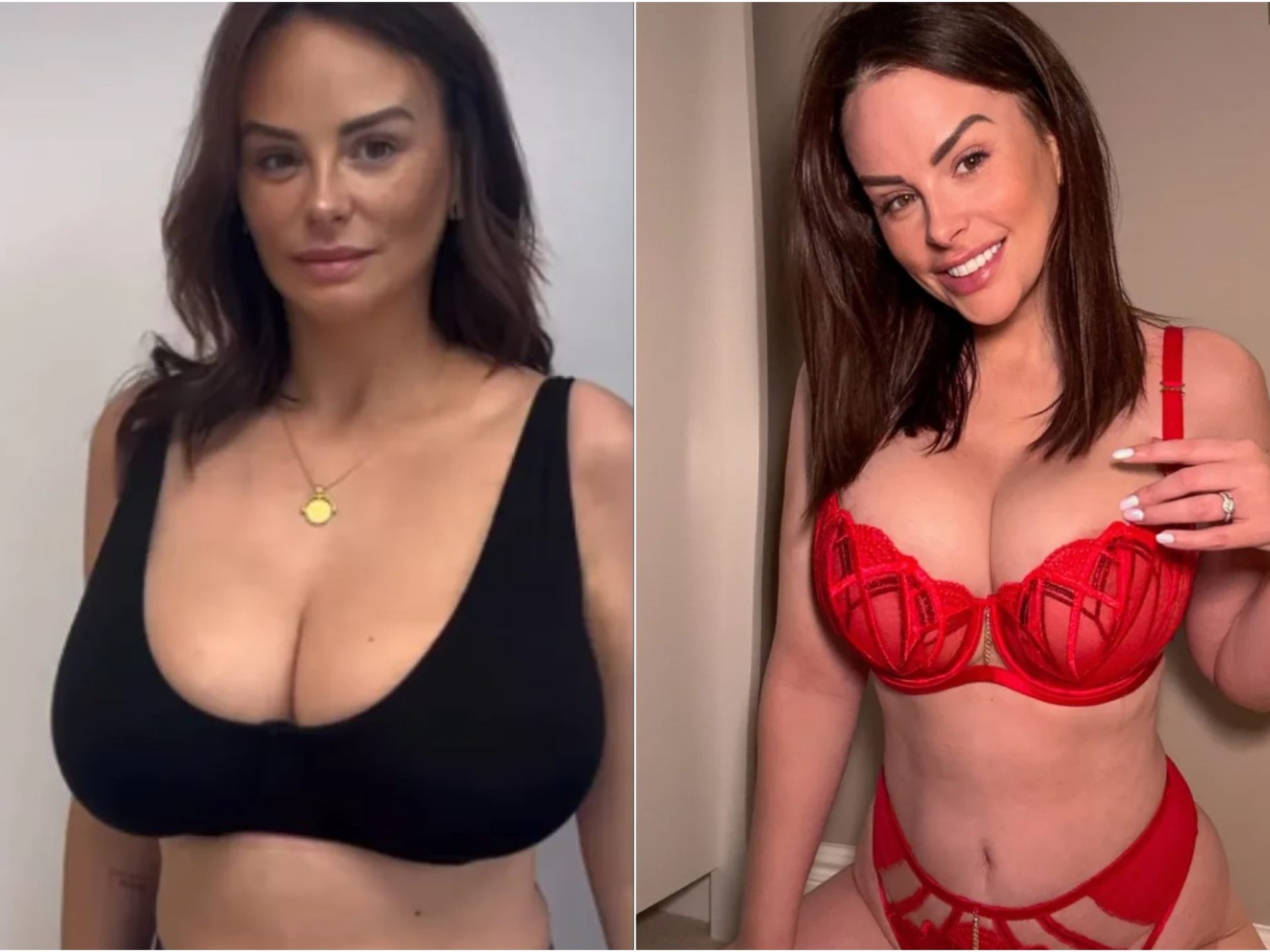 Rhian Sugden parla della riduzione del seno: foto in lingerie e il motivo della decisione