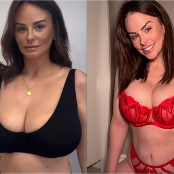 Rhian Sugden habla sobre la reducción de senos: fotos en lencería y las razones detrás de la decisión