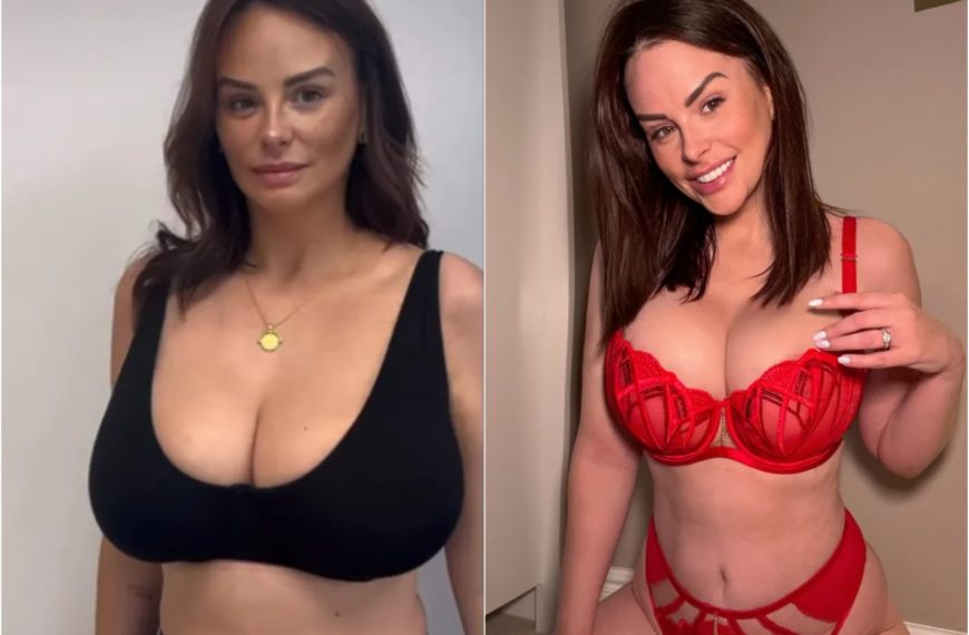 Rhian Sugden parla della riduzione del seno: foto in lingerie e il motivo della decisione